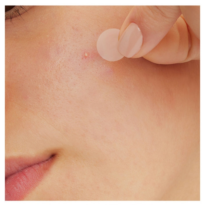 CeraVe Anti-Imperfection Patches box of 22 in two sizes 10mm and 12mm for targeted blemish treatment on sensitive skin