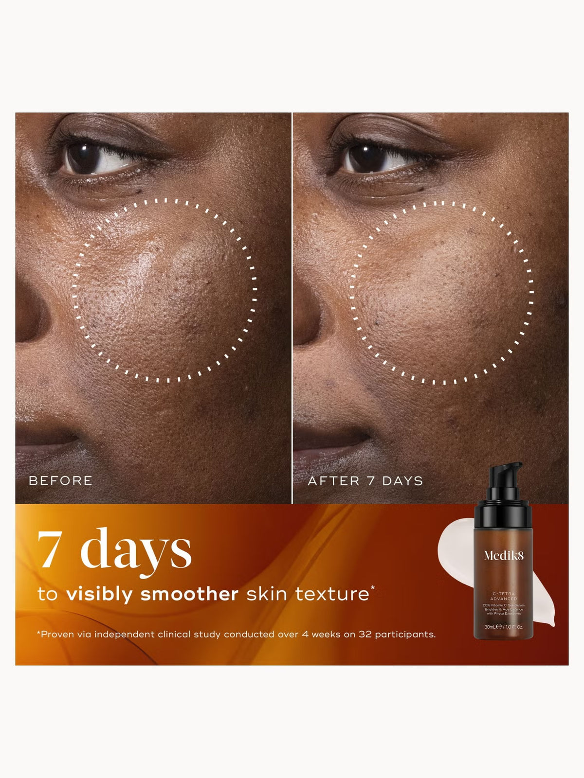 Medik8 C-Tetra Advanced 30ml clinically proven to visibly reduce wrinkles and brighten skin in 7 days with 20% vitamin C