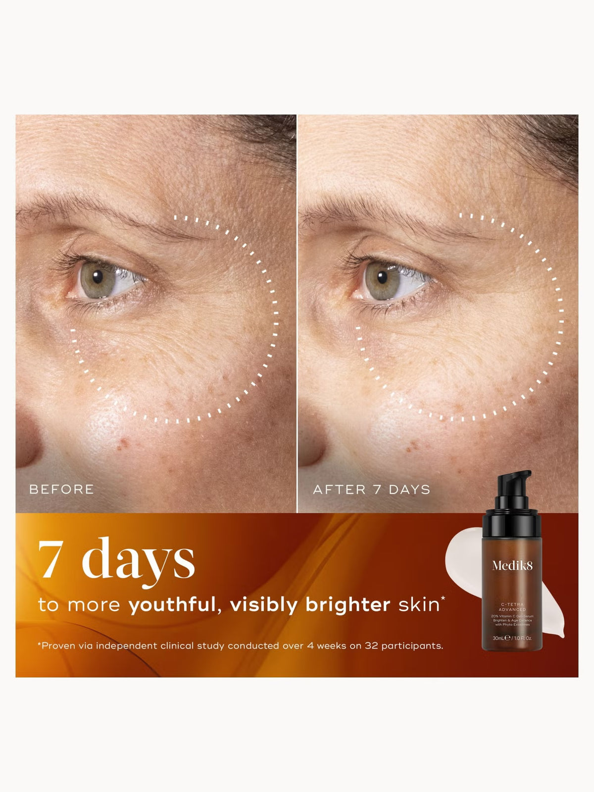 Medik8 C-Tetra Advanced with phyto exosomes acetyl zingerone and vitamin E for antioxidant protection and fast-absorbing brightening results