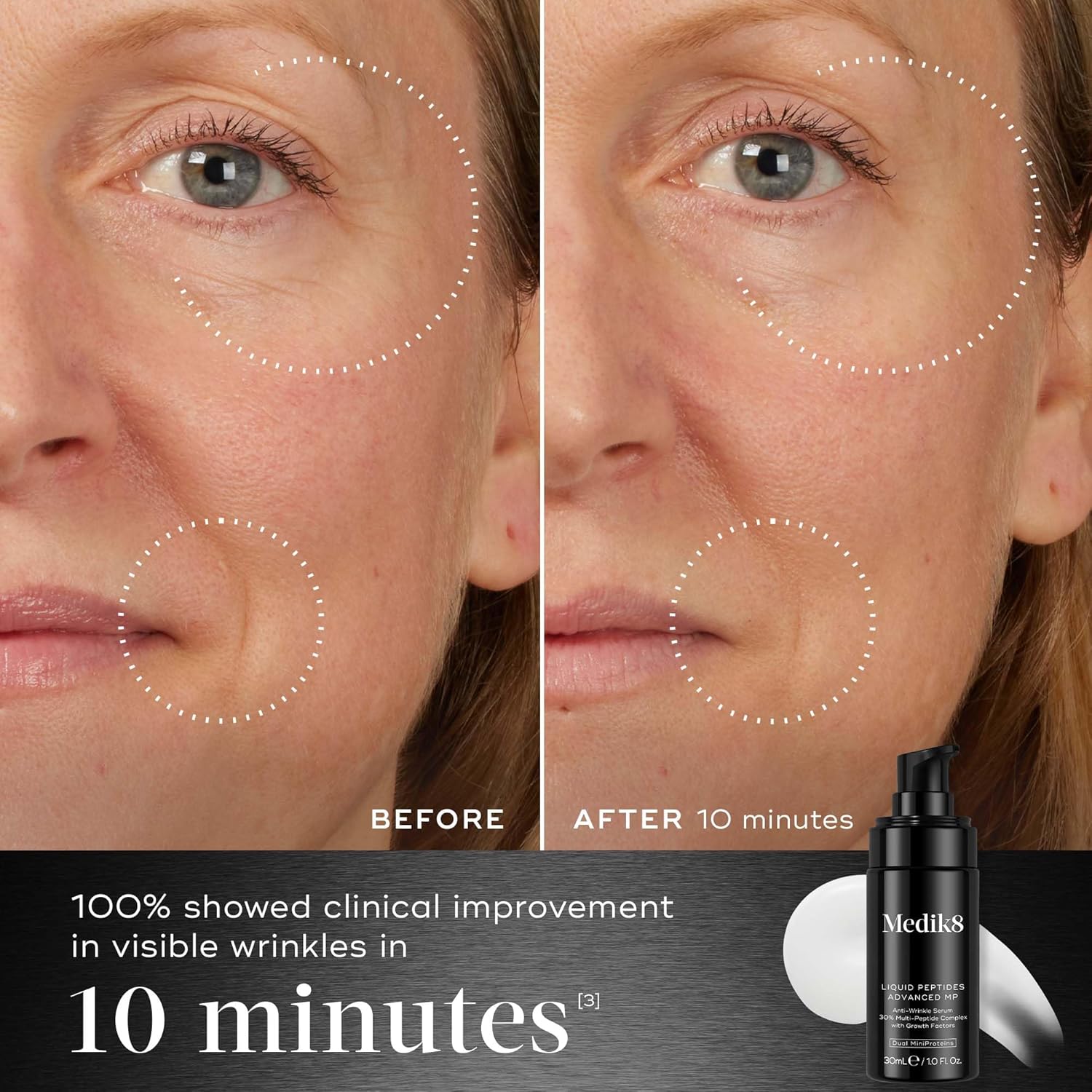 Medik8 Liquid Peptides Advanced MP featuring Expression Line MiniProtein, Growth Factor MiniProtein and MATRIXYL 3000 for visibly firmer skin