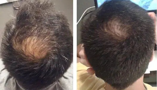 Reseed R8 Botanical Hair Solution for men with thinning or fine hair, helps encourage thicker, healthier-looking hair with daily use