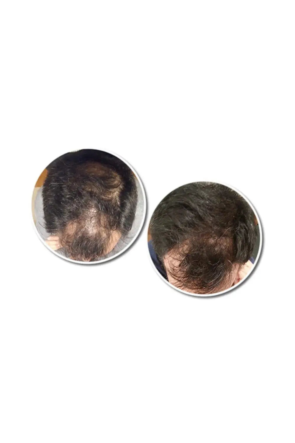 Reseed R12 Hair Serum for men with thinning or fine hair, helps encourage stronger, healthier-looking hair with daily use