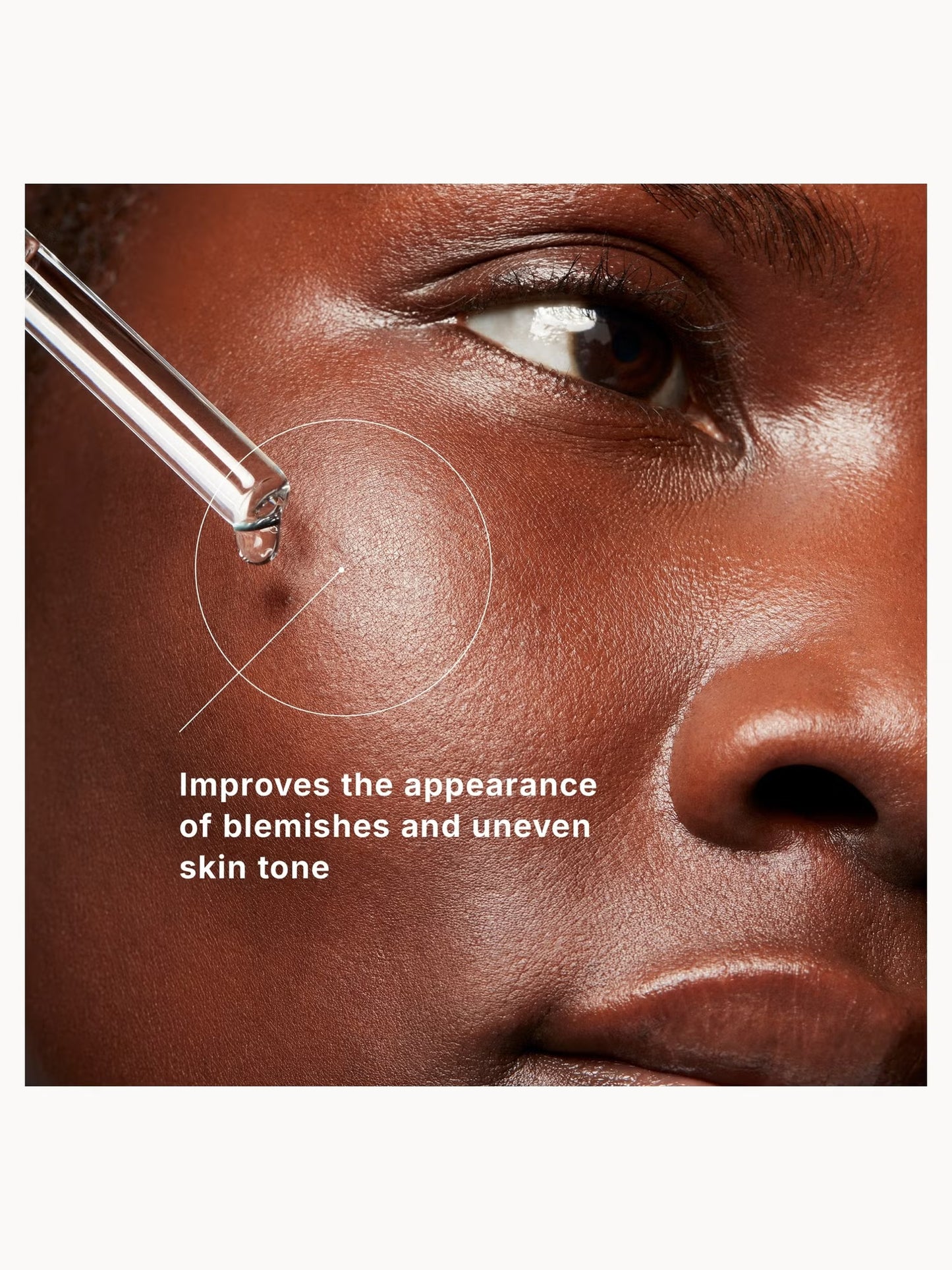 SkinCeuticals Blemish + Age Defense for adults with oily acne prone skin helping reduce breakouts, refine pores and improve uneven skin texture and ageing concerns